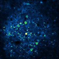 Local and global brain activity dynamics are coordinated, but only during conscious states