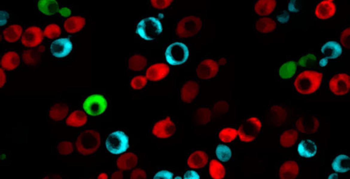 Different budding yeast strain