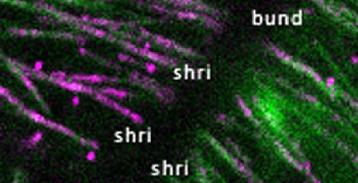NEK6 (purple) and microtubule (green) at a plant cell edge: