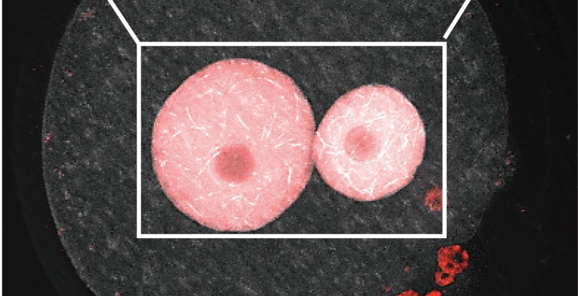 Nuclear actin filament formation in pronuclei of a mouse embryo at the one-cell stage.