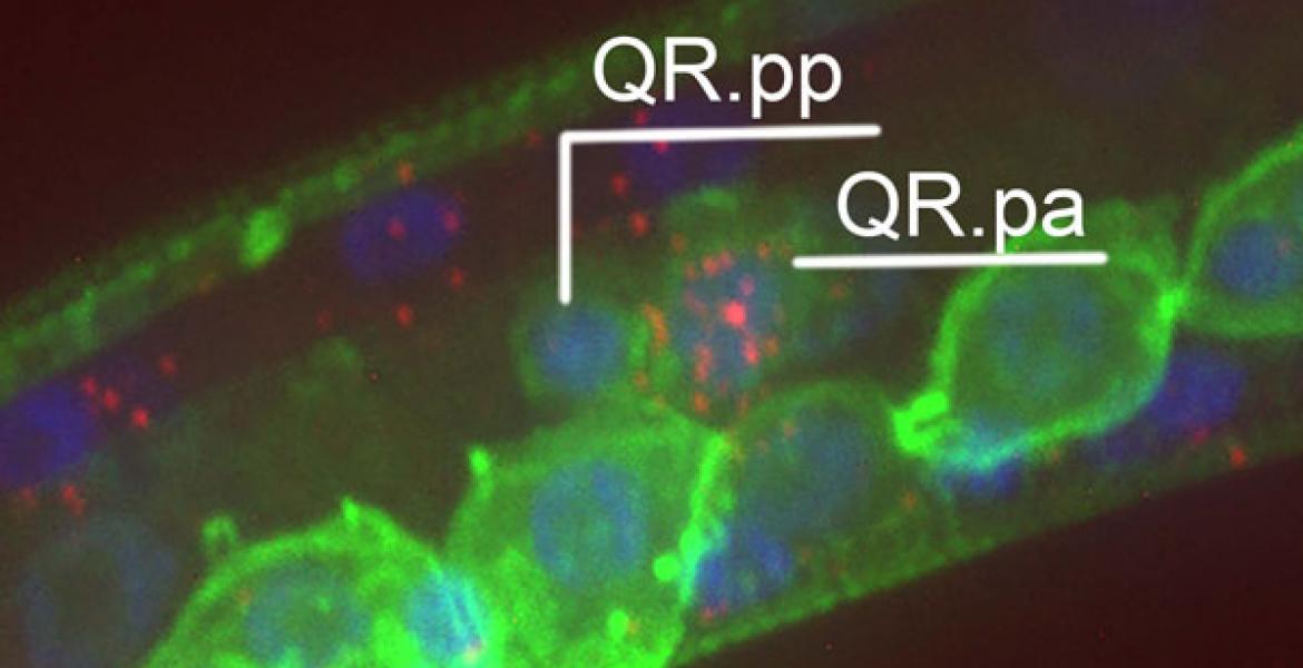 Single molecule fluorescent in situ hybridization visualization of mig-1 mRNA molecules