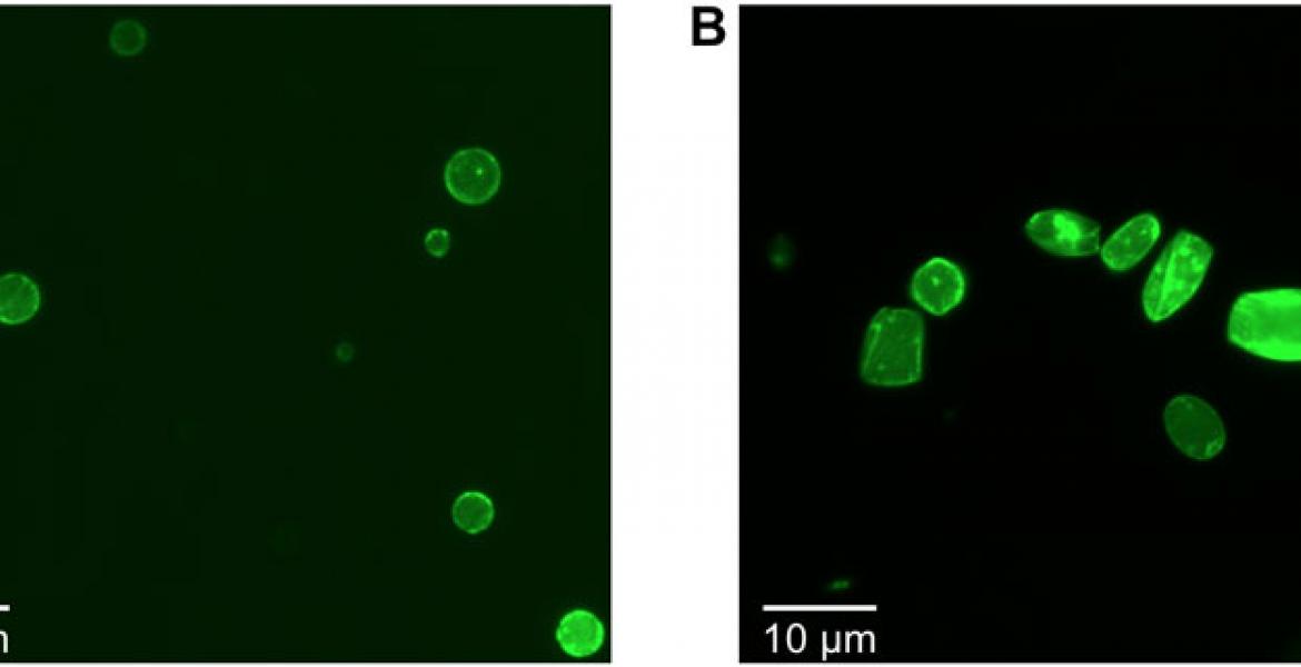 Cell-free synthesis of the MreB and eGFP-MreB proteins into cell-sized liposomes