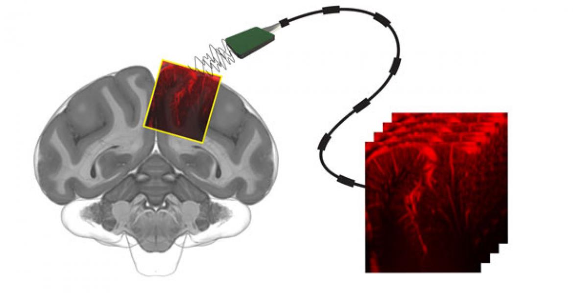 Functional ultrasound imaging (fUS) to record brain activity