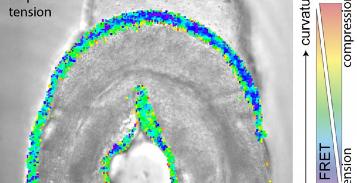 A single animal expressing a genetically encoded tension sensor 