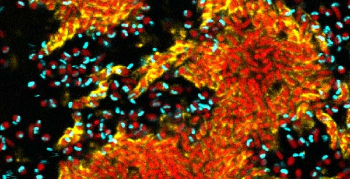 A confocal micrograph of biofilm clusters of Vibrio cholerae 