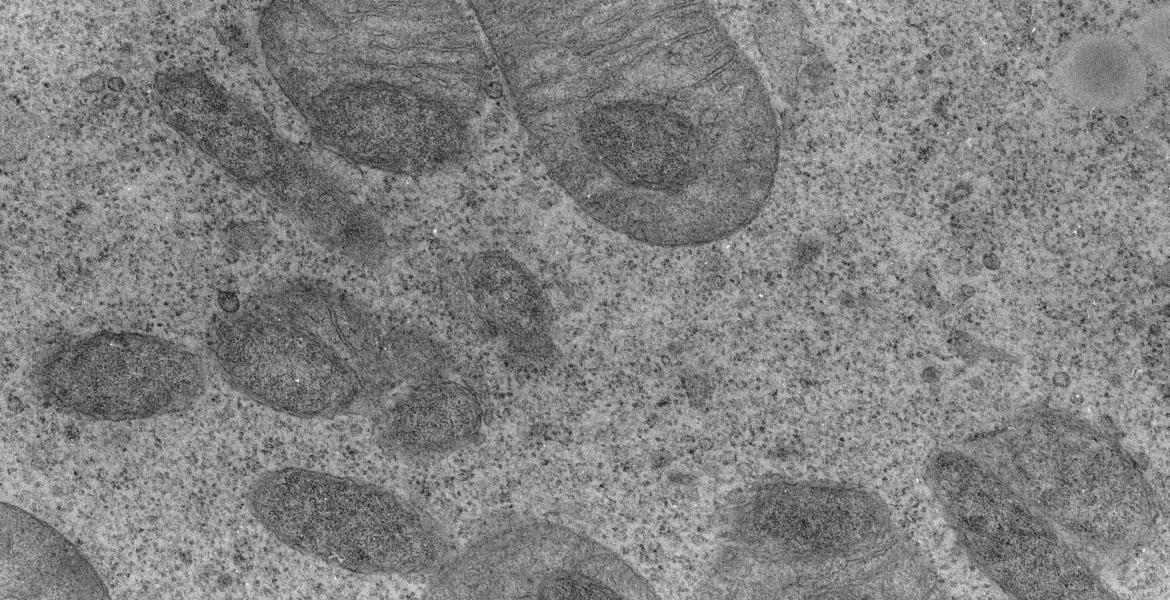 Transmission electron microscopy image of an oocyte 