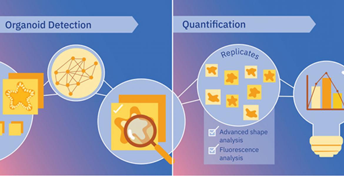 MOrgAna workflow