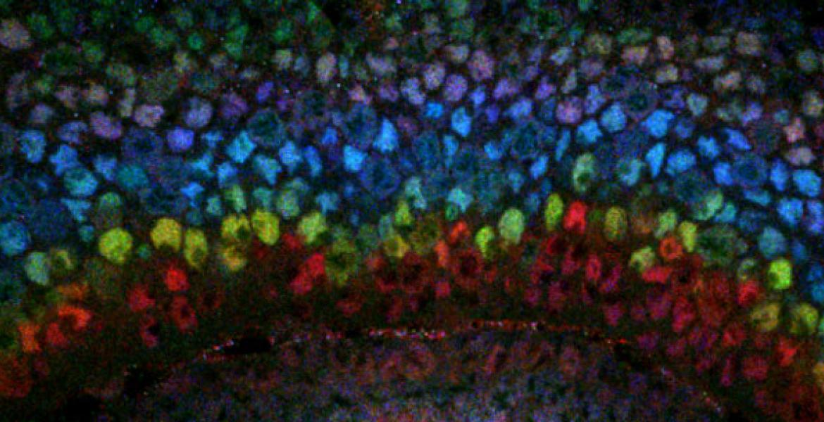 Confocal microscopy image of the developing fly optic lobe