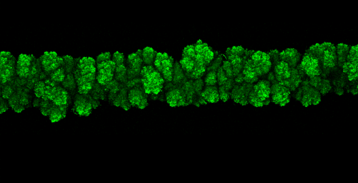 Snapshot of an E. coli colony displaying morphological instability and roughening after 37 hours of growth. The image shows maximum-intensity projections of the confocal optical slices taken at different depths in the medium