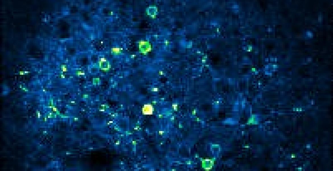 . Local neural assembly activity captured in the somatosensory cortex using 2-photon calcium imaging. Active neurons appear yellow; the circular cell bodies can be seen along with neural processes (dendrites and axons). The dimensions of the figure are 400 µm x 400 µm.