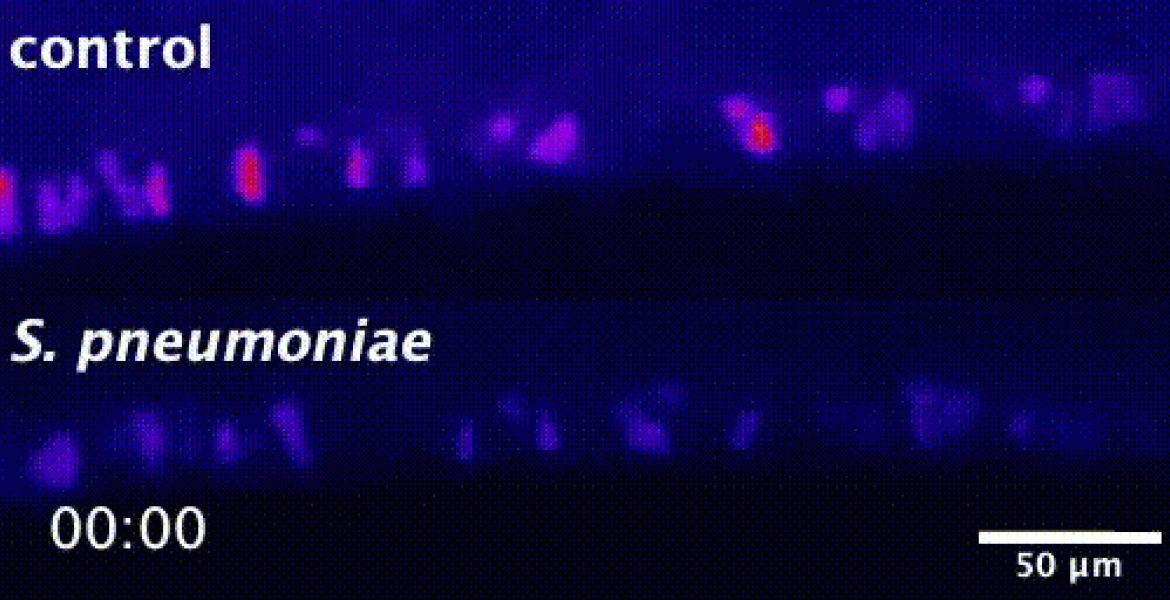 Cells responding to the bacteria in vivo