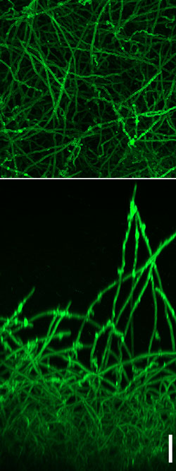 Figure: C. albicans biofilm as observed under the confocal microscope. The biofilm is formed by a basal layer of cells with yeast morphology and a think upper layer of filamentous cells. The lower panel shows the side-view and the upper panel, the top-view of the biofilm. The scale bar represents 50 μm.